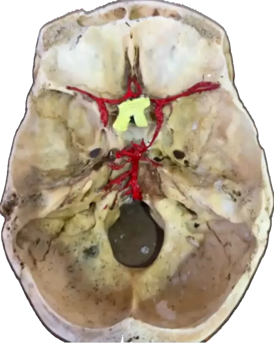 Base of skull showing COW