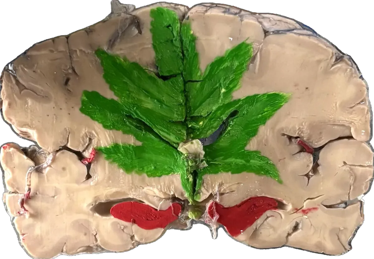 Cannabis Poisoning