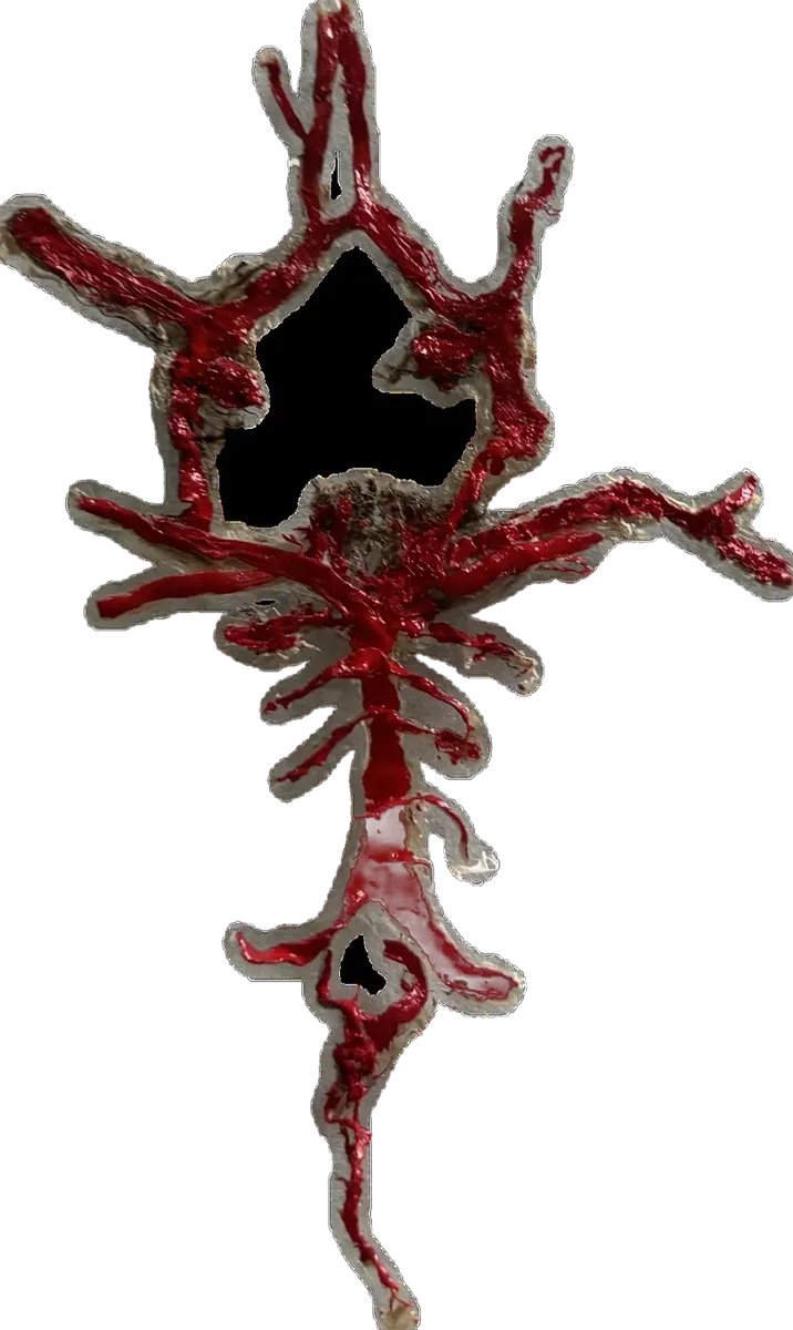 Circle of Willis