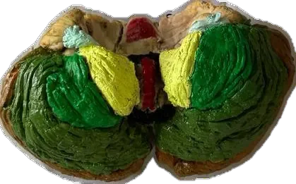 Inf surface of cerebellum