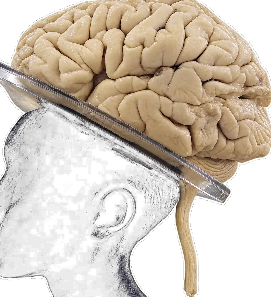 Infant Brain with Spinal Cord