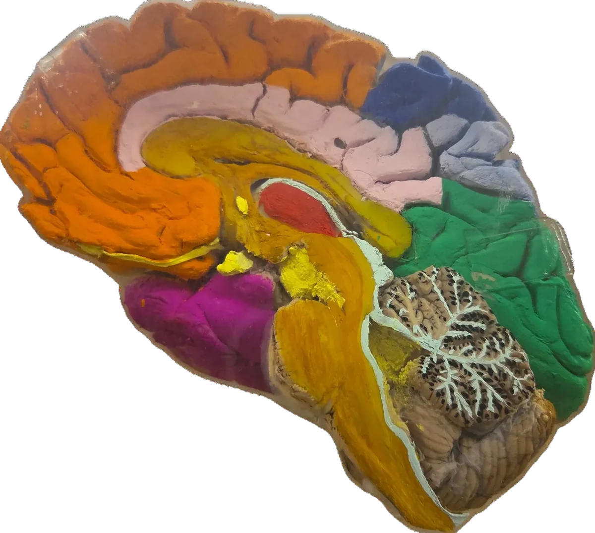 Sagittal section showing lobes