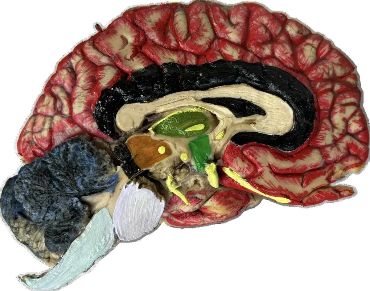 Sagittal section showing structures in r/w corpus callosum