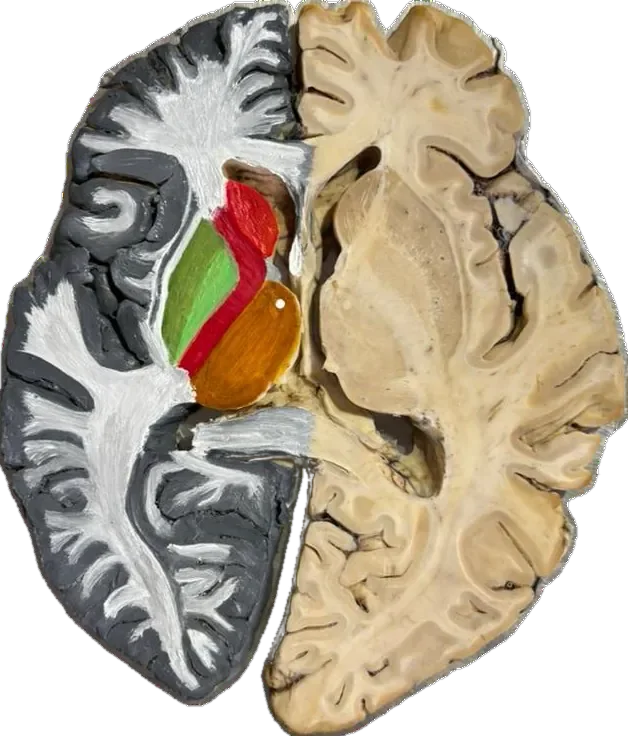 Transverse section showing internal capsule structures