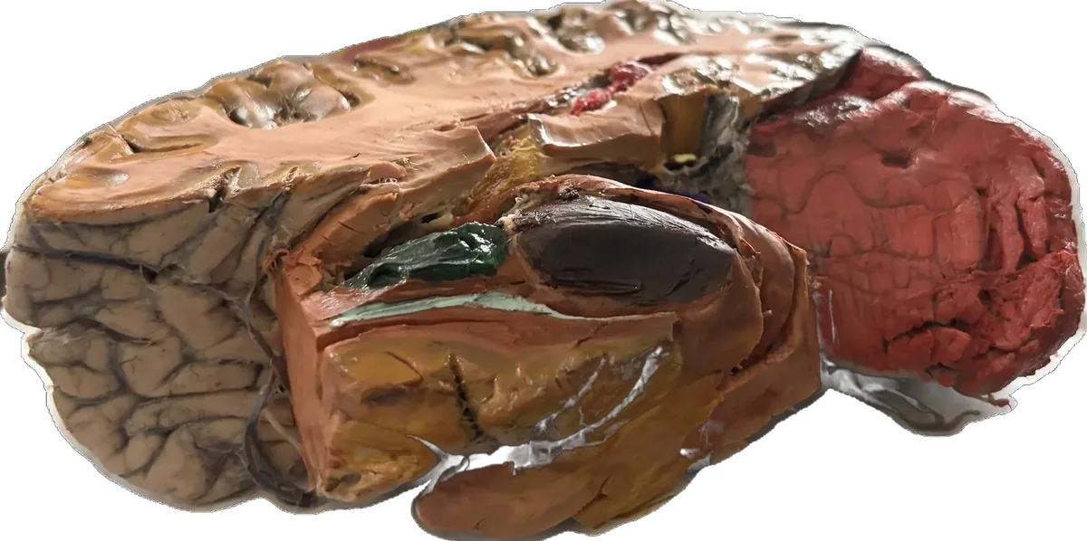 T/S to show structures of basal ganglia