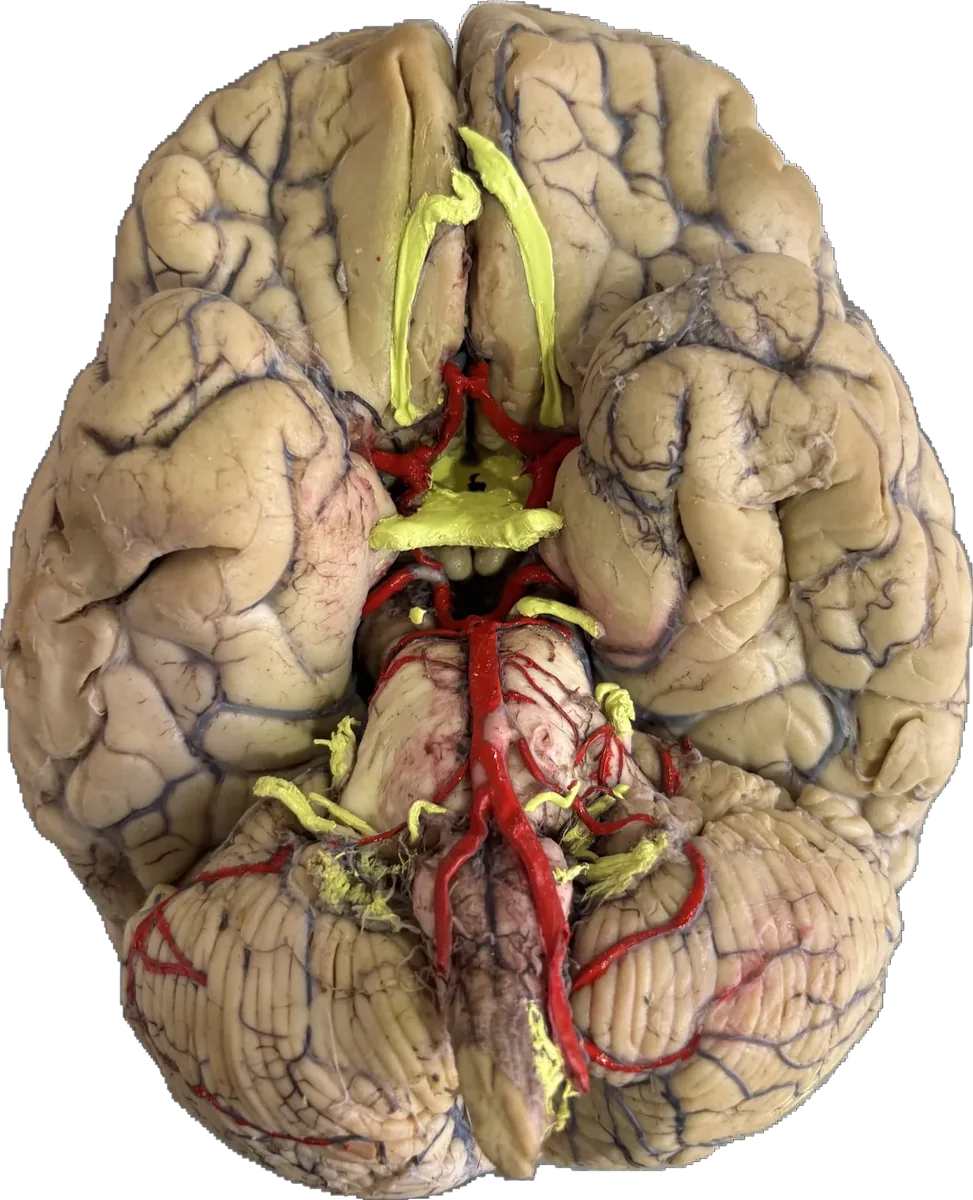 Whole brain inferior surface - Circle of willis