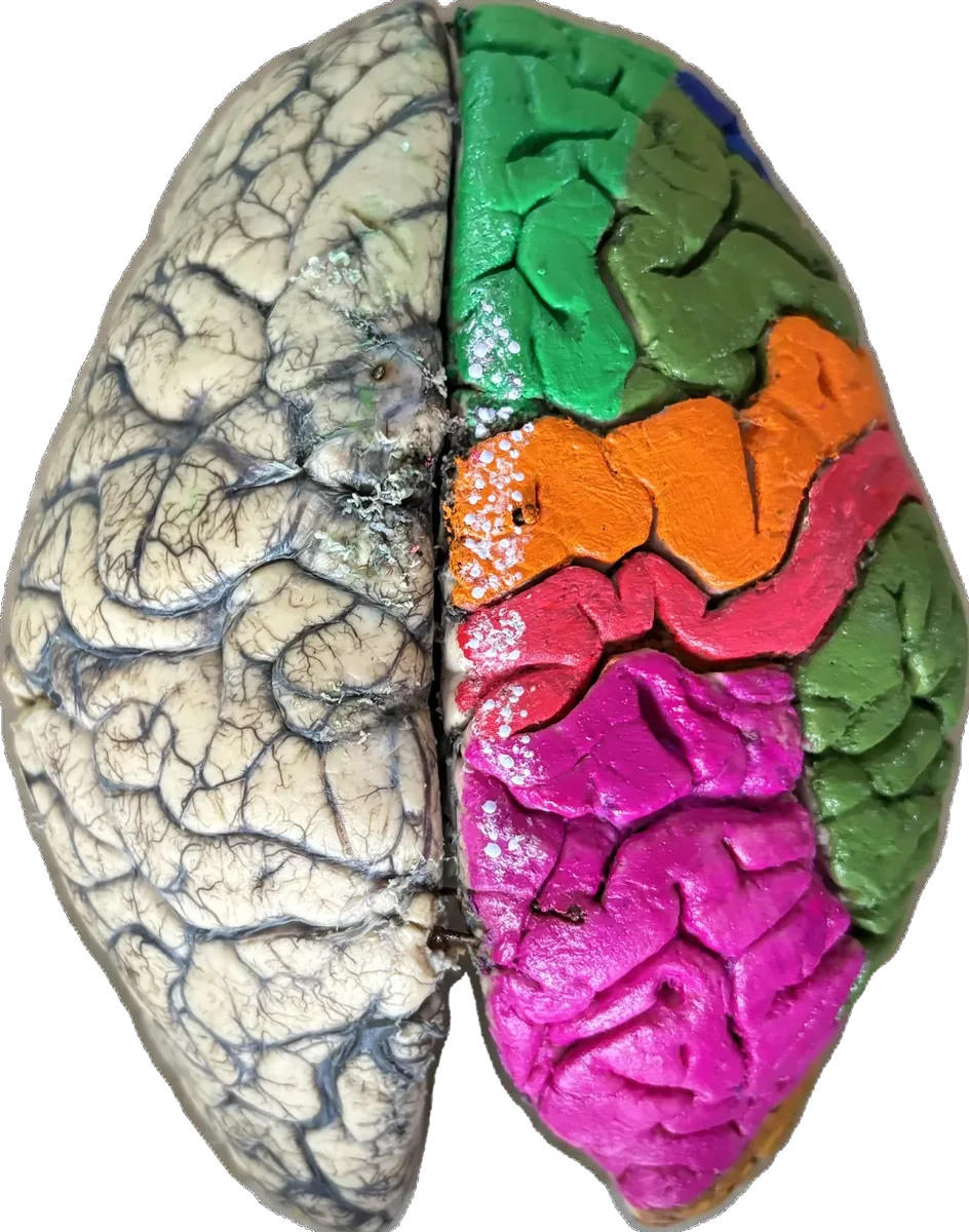 Whole brain superior surface